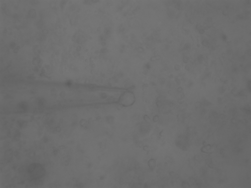 Figure 5: 29.7° C, Initial stage of the vesicle